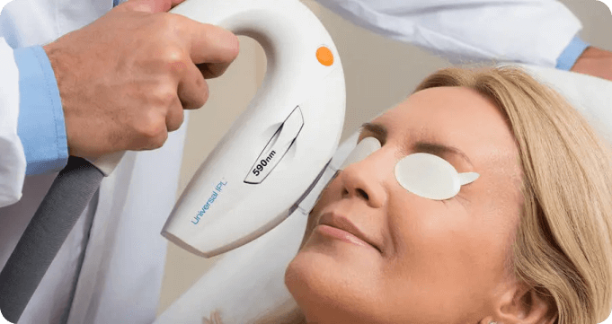 woman getting lumenis nuera tight treatment on face