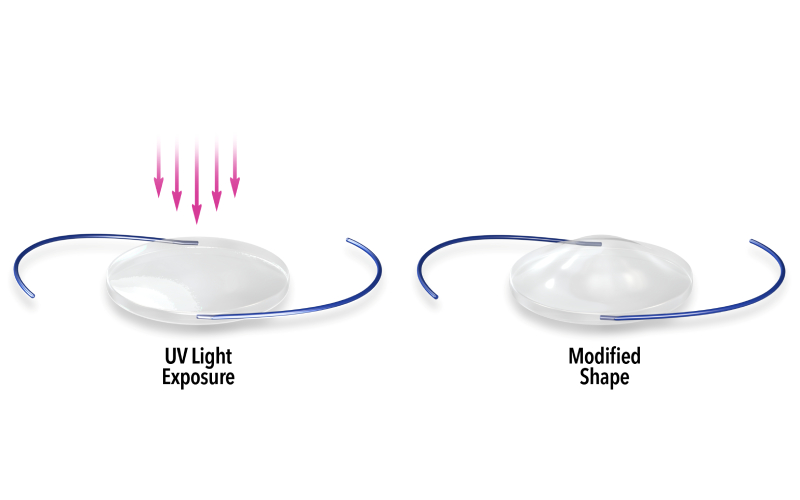 Fixed lenses vs Light adjustable lenses at California LASIK and Eye